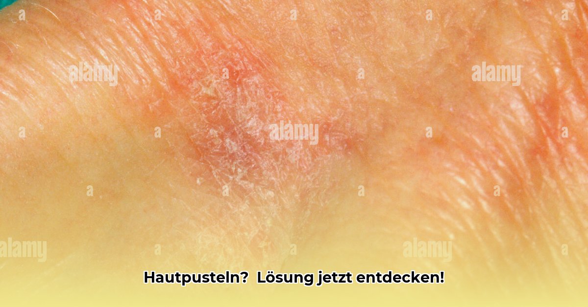 hautpustel